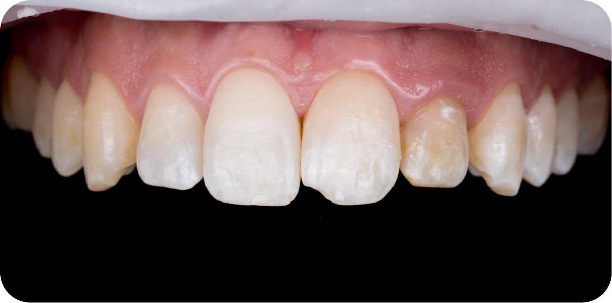 Original - Man holding beer