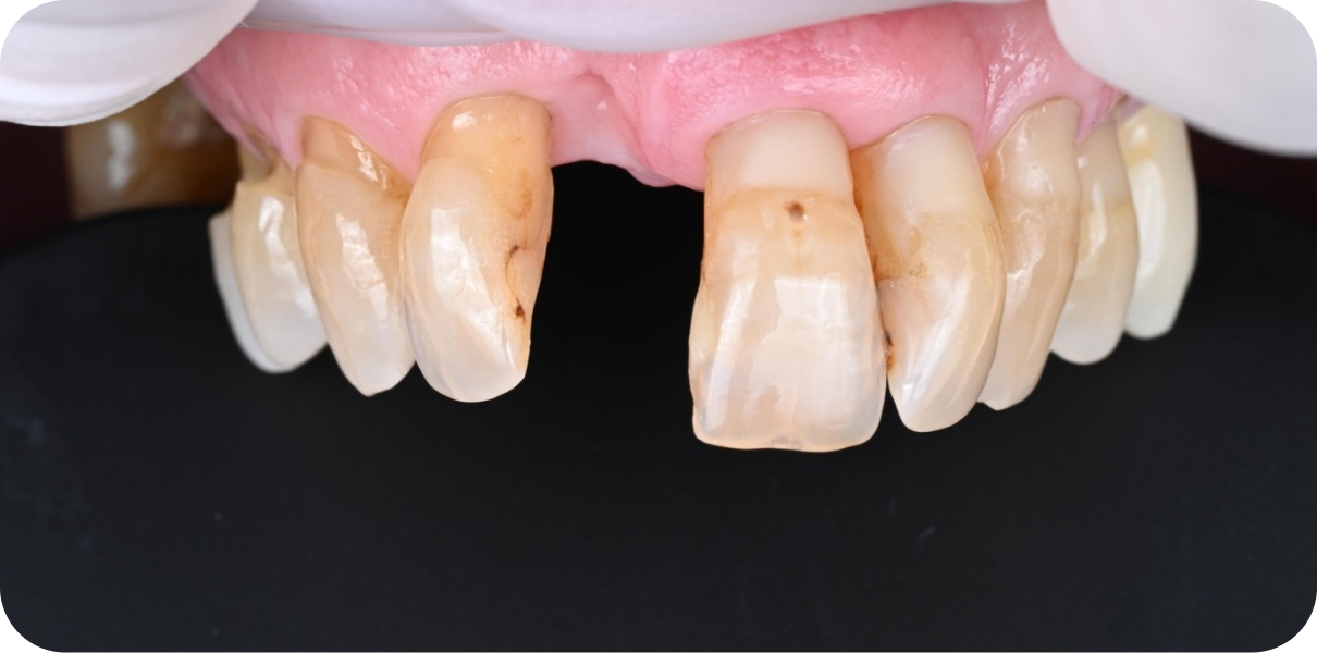 Original - Man holding beer