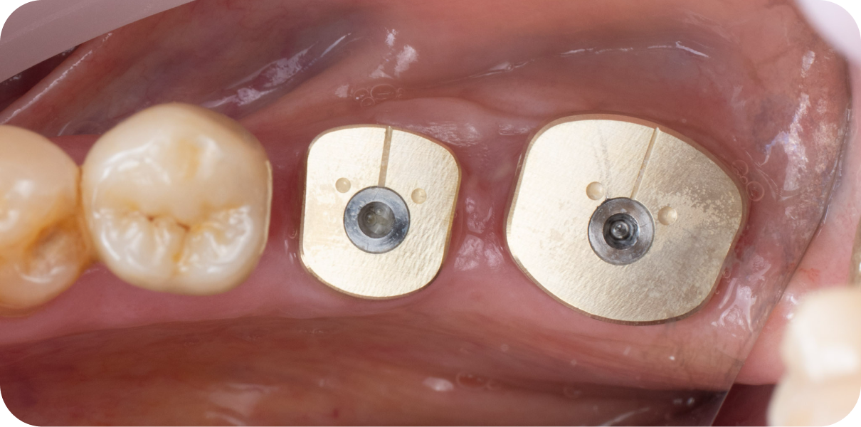 Original - Man holding beer