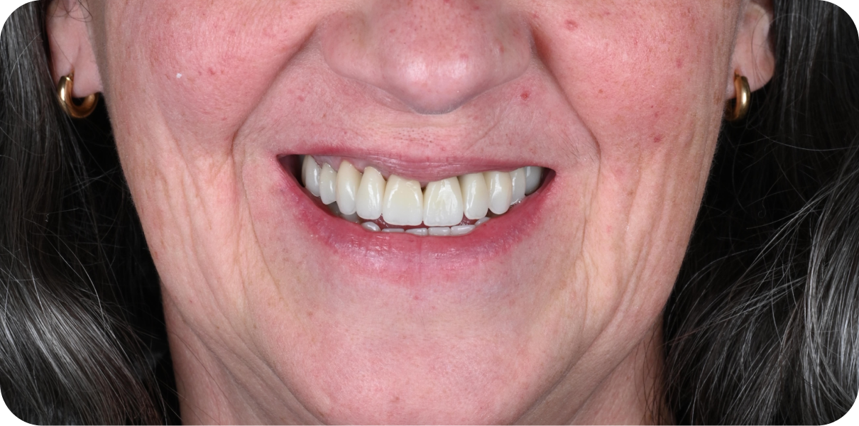 Processed - Man holding beer